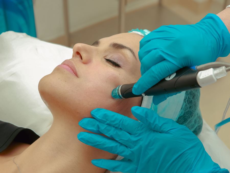 HydraFacial treatment